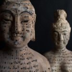 Acupuncture-is-an-ancient-Chinese-methodology